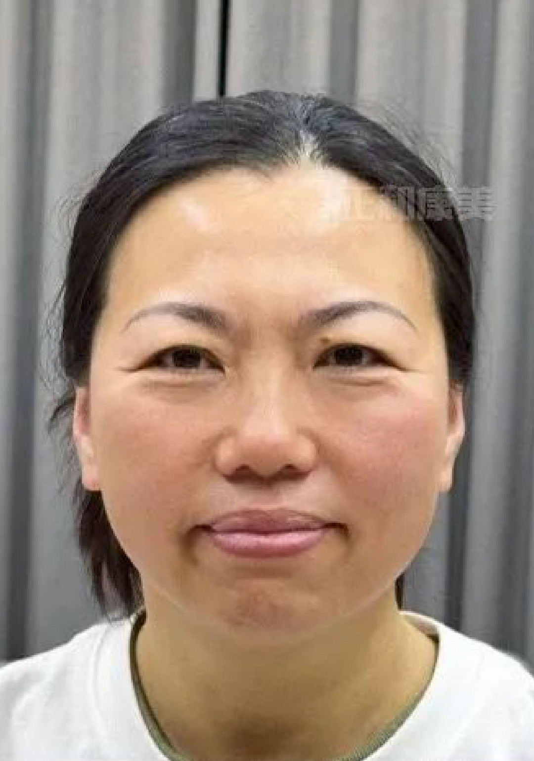 学员案例1